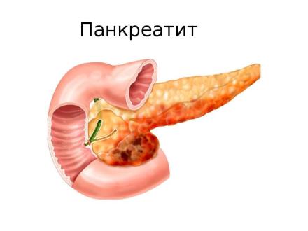 Сильная женщина и слабый мужчина. Где причина, а где следствие?